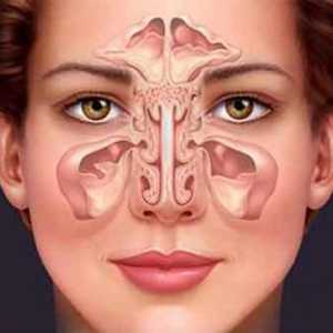 Bilo da je moguće zagrijati nos na genyantritisu? Uz genyantritis možete zagrijati nos ili ne?