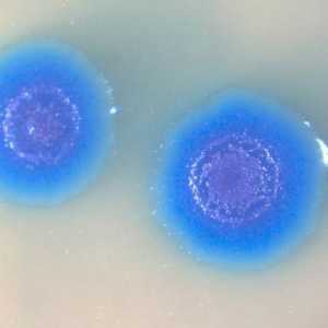 Mycoplasma genitalium: što je to? Koliko je opasna zaraza?