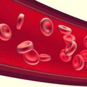 Kršenje protoka krvi tijekom trudnoće: uzroci, simptomi, liječenje