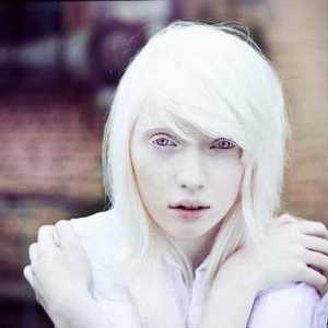 Nastya Zhidkova: albino model s nestandardnim izgledom
