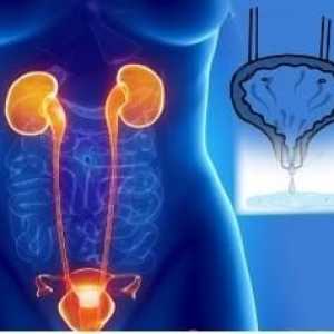 Mokraćna inkontinencija kod starijih žena: liječenje i uzroci