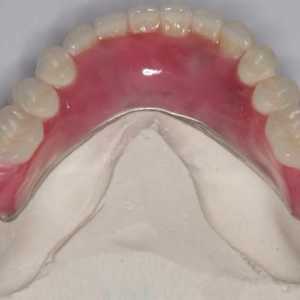 Najlona proteza s potpunim odsutnim zubima i djelomično. Recenzije o najlonskim protezama