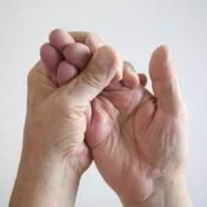Nemetov prst desne ruke: uzrok i posljedica