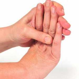 Nemetova ruka: uzroci i odgovarajući tretman