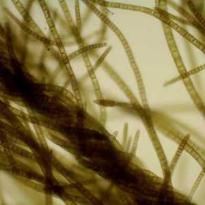 Vlaknaste alge: faze razvoja, reprodukcije, kako se uklanjaju iz akvarija?