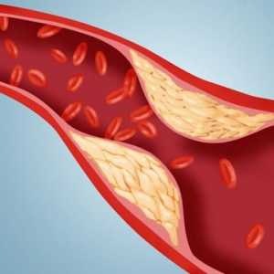 Norma kolesterola u krvi ljudi. Pokazatelji kolesterola u krvi