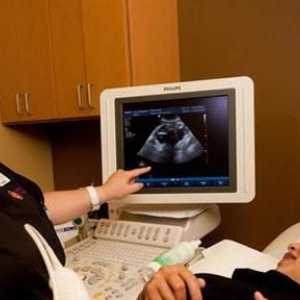 Norma za screening ultrazvuk je 1 trimestra. Screening za prvi trimestar: vrijeme, ultrazvuk,…