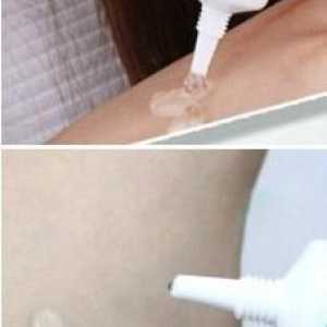 Nuobisong (vrhnje): recenzije i učinkovitost. Je li Nuobisong gel ukloniti ožiljke i ožiljke?