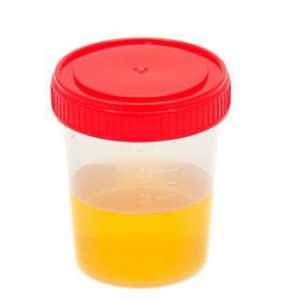 Što će `reći` analizu urina (dekodiranje) u djece
