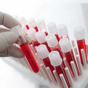 Identifikacija leukocita u analizi krvi. prijepis