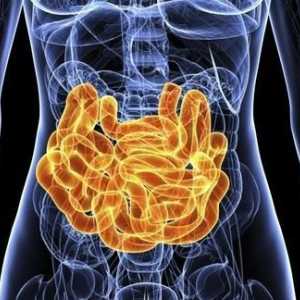 Opstrukcija intestinalne obustave: uzroci, simptomi, dijagnoza i metode liječenja