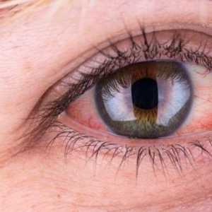 Ocalin u oku - što da radimo? Prva pomoć za traumu oka