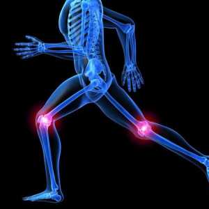 Operacija artroplastije koljena: recenzije. Endoprotetika koljena: rehabilitacija