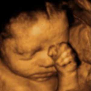 Određivanje spola djeteta ultrazvukom, koliko je točno