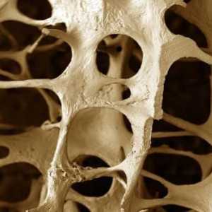 Osteopenija - što je to i koje su metode liječenja