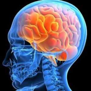 Edem mozga: uzroci i posljedice. Cerebralni edem u djece i odraslih