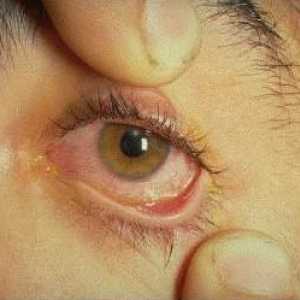 Ožiljak: prva pomoć i liječenje