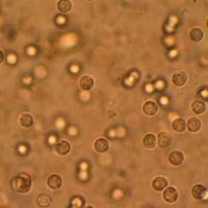 Patogene bakterije u urinu, što to znači?