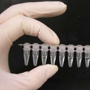 PCR-dijagnoza infekcija i opseg njegove primjene