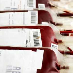 Transfuzija krvi po skupinama krvi: pravila. Univerzalni donatori. Tablica kompatibilnosti skupina…