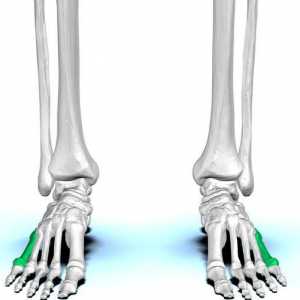 Fraktura pet metatarsalnih kosti stopala: dijagnostika, rehabilitacija, prognoze