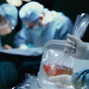 Transplantacija bubrega: operacija u kojoj se radi, život nakon intervencije, red