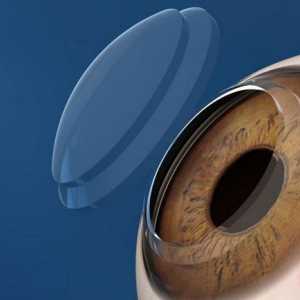 Transplantacija rožnice oka: opis, indikacije, troškovi, recenzije. Mikrokirurgija oka