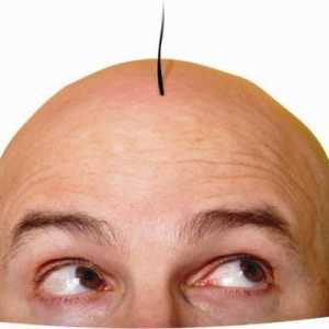Transplantacija kose: recenzije, cijene, fotografije