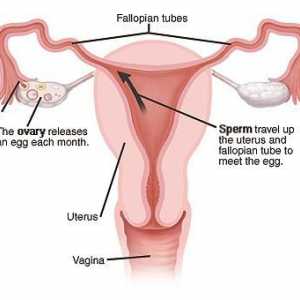 Spajanje cijevi u žena: posljedice. Što bi moglo biti posljedice cjevovoda?