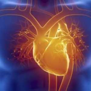 Prva pomoć za infarkt miokarda. Znakovi srčanog udara