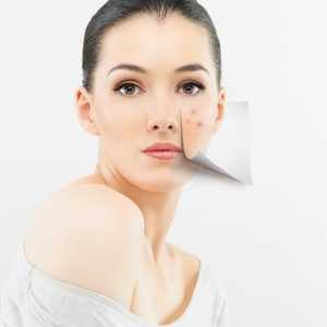 Pigmentirane mrlje na licu: uzroci, liječenje
