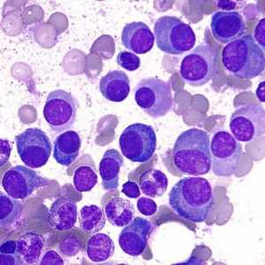 Plazma stanica je važna komponenta u leukocitnom mediju