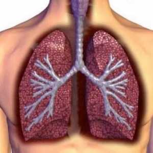 Pleuritis pluća: što je to, kako liječiti narodne lijekove? Uzroci, simptomi i liječenje pleurije…