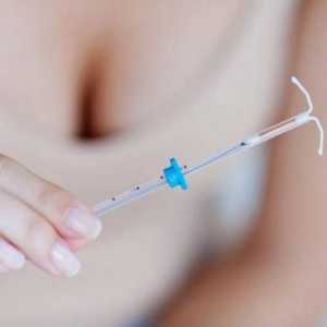 Pro i kontra intrauterine naprave od trudnoće