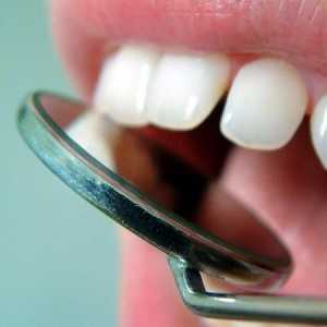 Zašto su zubi ozlijeđeni nakon uklanjanja živaca: mogući uzroci i načini liječenja