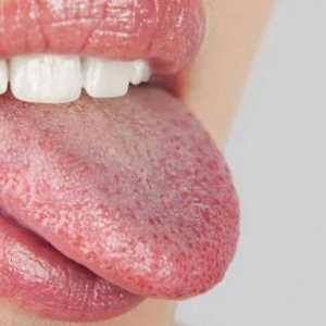 Zašto pletu u ustima: uzroci, simptomi i karakteristike liječenja