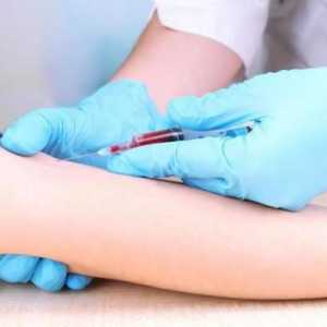 Priprema za biokemijski test krvi: pravila i savjeti