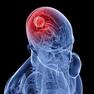 Posljedice encefalitis kod odraslih i djece