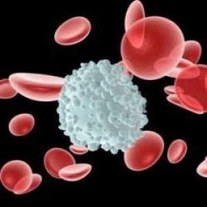 Povišeni limfociti u krvi: uzroci zahtijevaju pojašnjenje