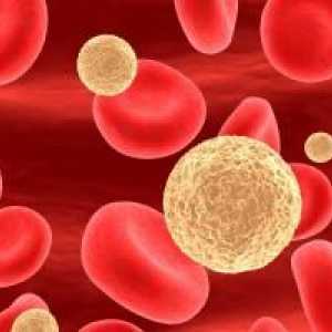 Povišeni krvni limfociti u djece: ono što trebate znati