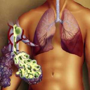 Desna strana upala pluća: uzroci, simptomi i liječenje
