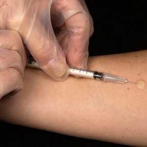 Mantoux cijepljenje: norma, odstupanje