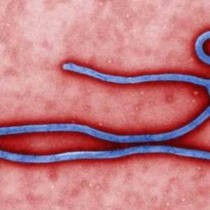 Sprječavanje vrućice Ebola. Ebola groznica: simptomi, liječenje