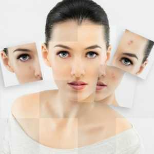 Lice pod kožnim aknama: uzroci, metode liječenja, lijekovi