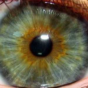 Iris oka: boja, mjesta, bolesti