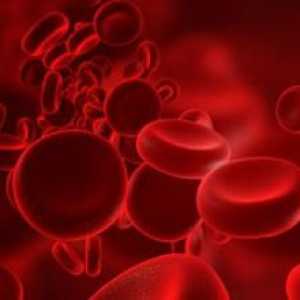 Rak krvi: simptomi kod žena. Simptomi raka krvi kod odraslih osoba