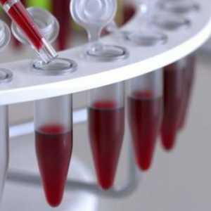 Dekodiranje HCT testa krvi, norma