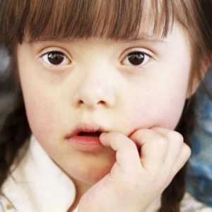 Dijete je spušteno - što to znači? Znakovi i simptomi Downovog sindroma