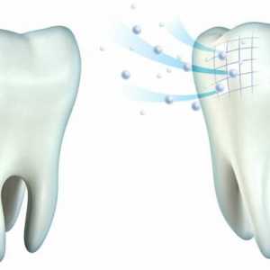 Remineralizacija zuba kod kuće: lijekovi