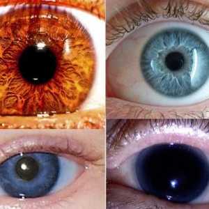 Najrjeđa boja očiju - što je to?